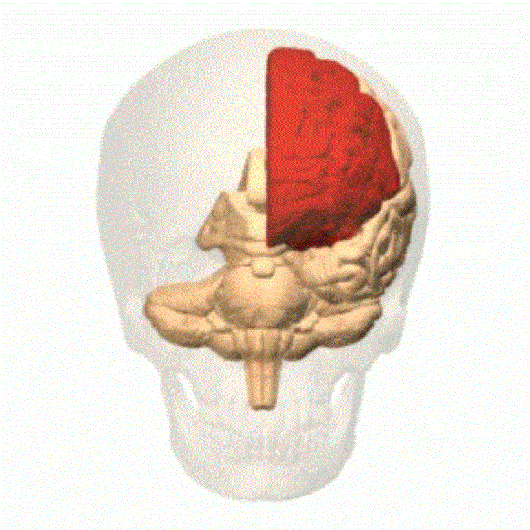 illustration of brain with shading to show area of injury on left side.